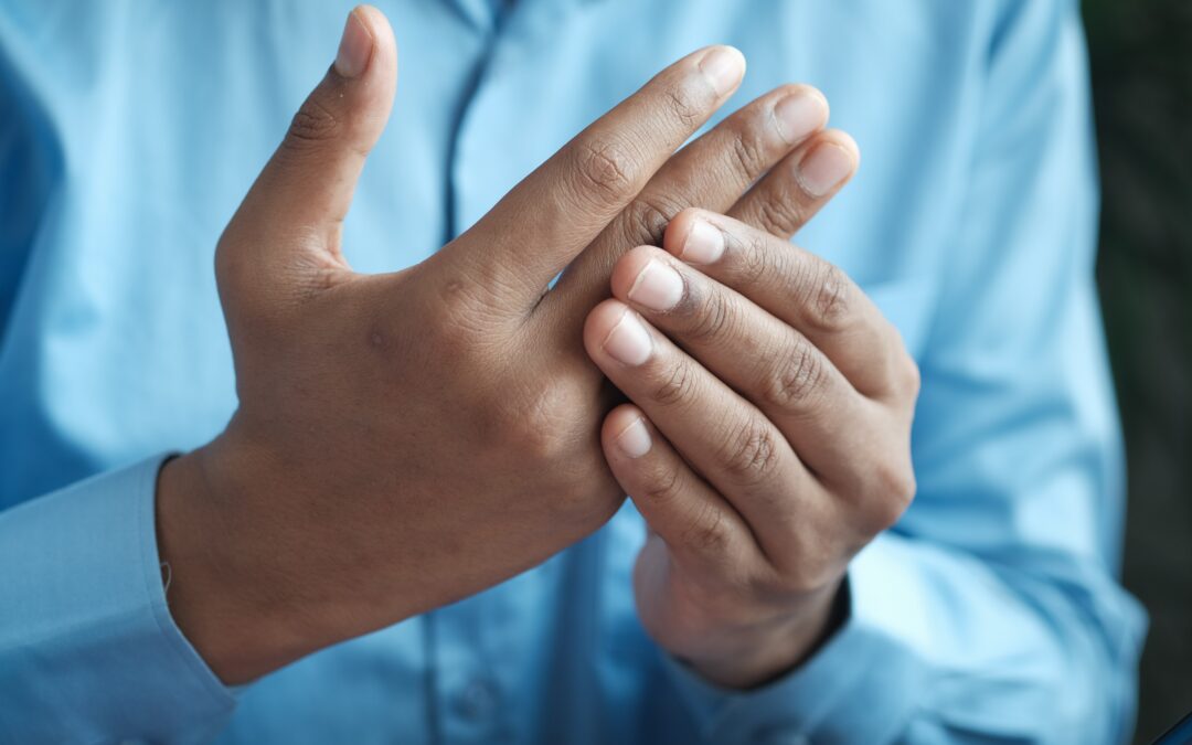 The Skinny on Rheumatoid Arthritis
